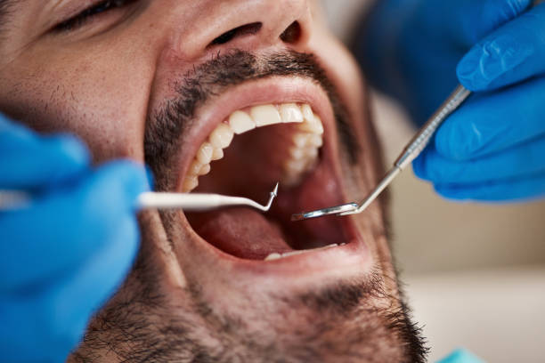 Best Mobile Emergency Dentist in Bella Vista, CA