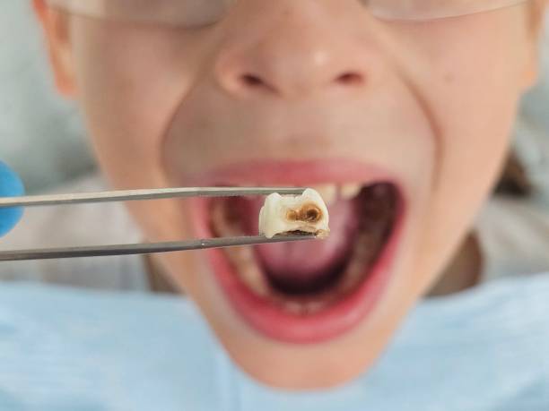 Best Pediatric Emergency Dentist in Bella Vista, CA